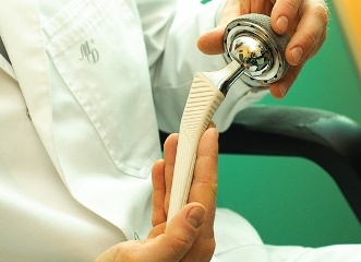 Эндопротезирование тазобедренного сустава в Израиле