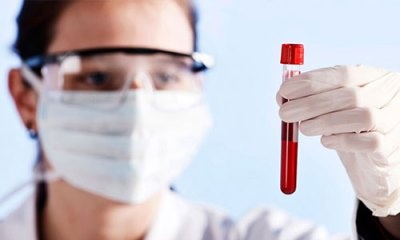 миелолейкоза что это такое. Смотреть фото миелолейкоза что это такое. Смотреть картинку миелолейкоза что это такое. Картинка про миелолейкоза что это такое. Фото миелолейкоза что это такое