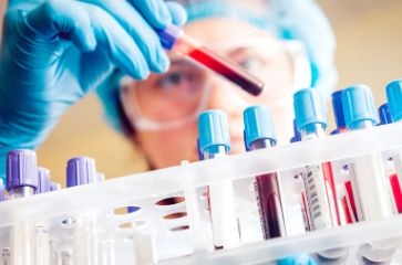 Исследование о защите от ВИЧ