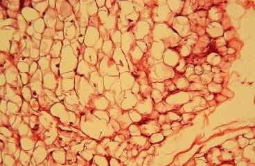 Сбалансированное питание и активный образ жизни